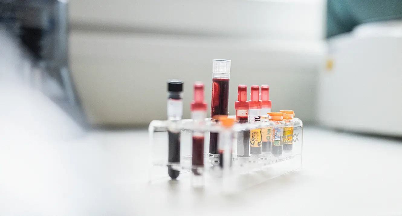 Spritzen mit Blut im Labor